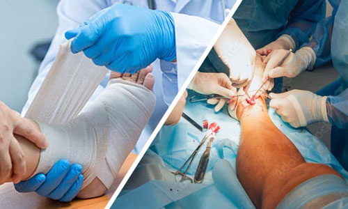 Complex Trauma Surgery in Nagpur