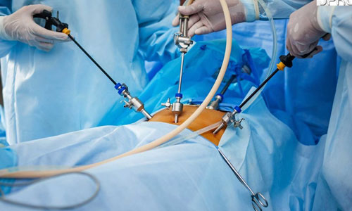 Endoscopic Spine Surgery in Nagpur