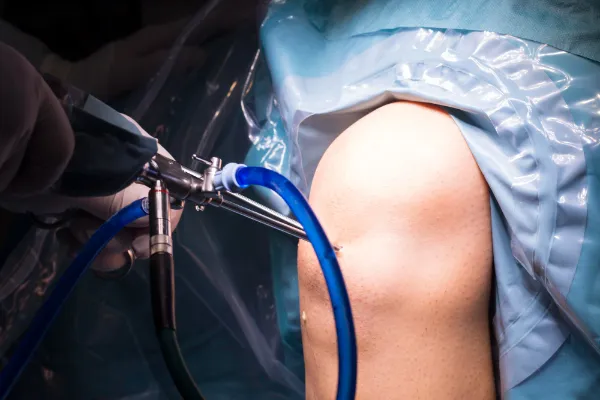 What is Knee Arthroscopy​